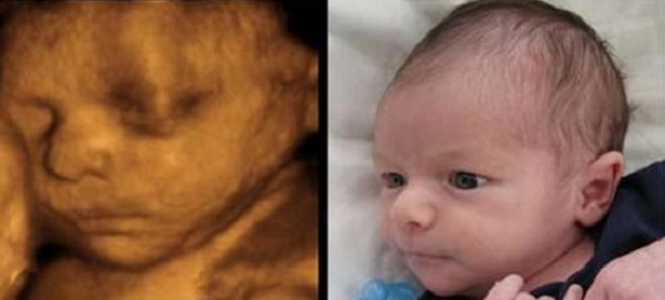 Cười không ngậm được mồm: Siêu âm thế nào con ra thế đấy, giờ mẹ đã tin chưa?