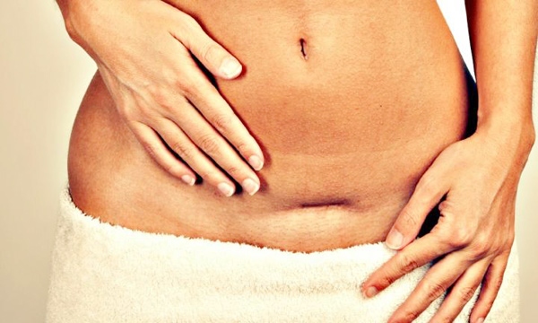 7 kiêng cữ sau sinh mổ mẹ bầu tuyệt đối phải ghi nhớ